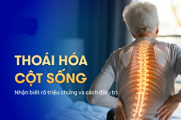 thoái hóa cột sống