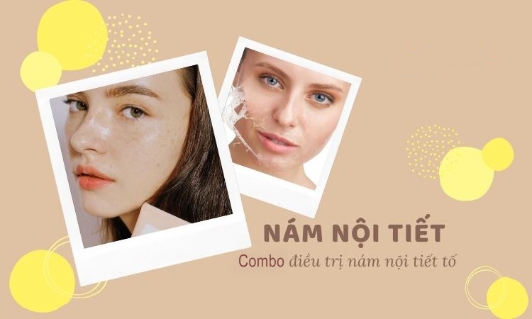 Combo Cân bằng nội tiết tố trị nám